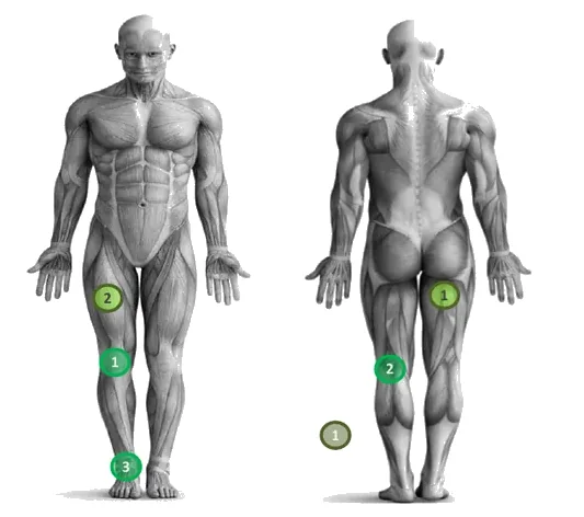 Exemplo de relatório da avaliação do joelho: figura do corpo, de frente e de costas, com os pontos a melhorar marcados